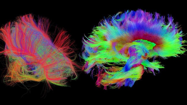 Fotos: Un escáner de nueva generación explora detalladamente el cerebro humano
