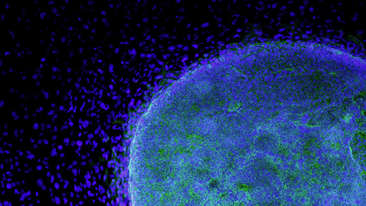 Resuelven el secreto de la inmortalidad de las células madre