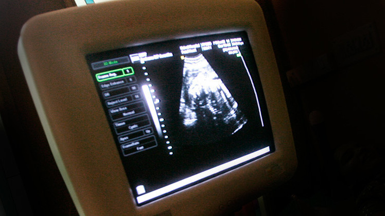 Feminista: "Decidí abortar cuando supe que mi bebé sería niño"