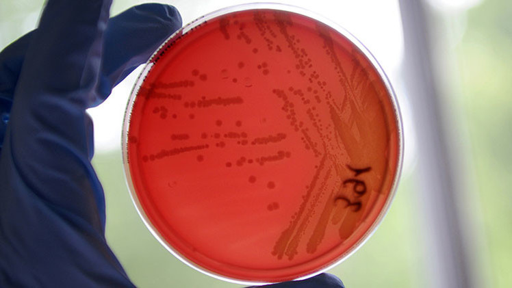Bacteria mortal escapa de un laboratorio secreto de EE.UU. 