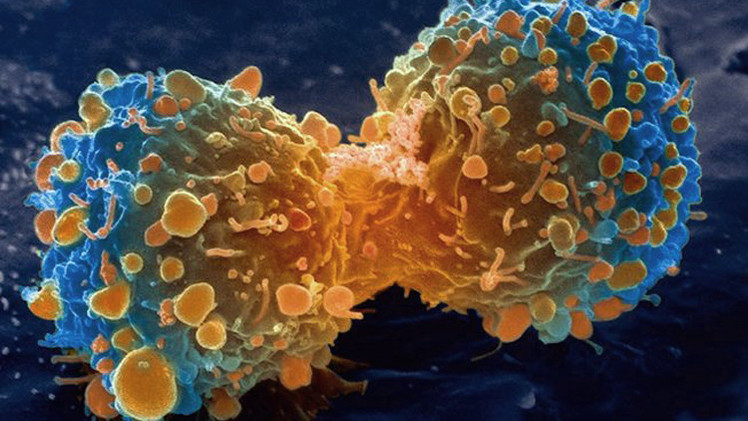¿Ya es posible curar las células cancerosas?