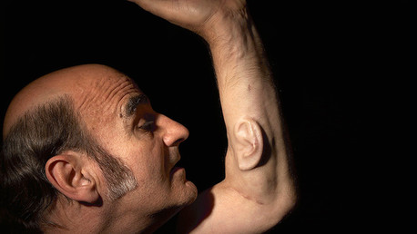 Un profesor australiano 'cultiva' una oreja en su brazo para conectarla a Internet