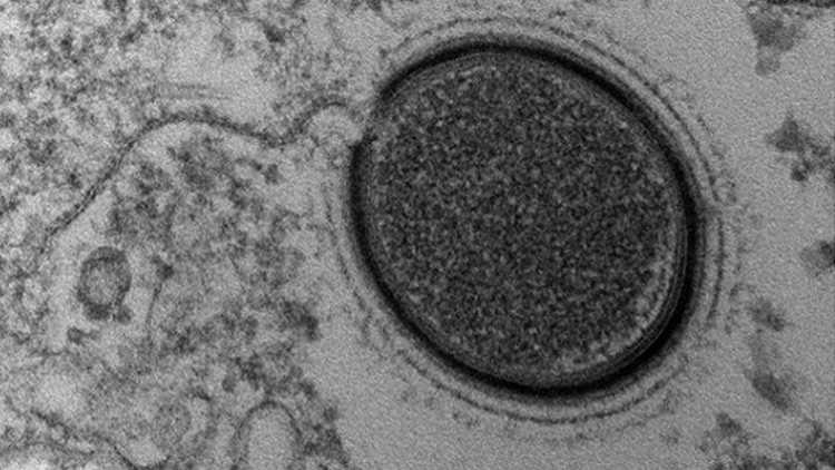 La ciencia 'resucitará' un virus prehistórico gigante en Siberia
