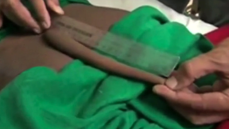 No apto para personas sensibles: Cortan una cola de 18 cm a un joven indio (VIDEO)
