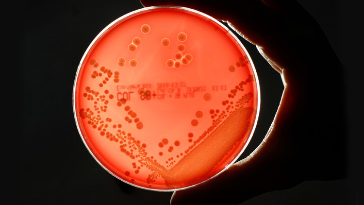 Se registra en Estados Unidos la primera muerte por una 'superbacteria' resistente a 26 antibióticos