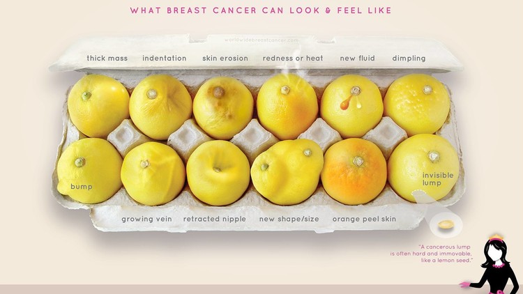 Cómo una docena de limones ayudó a una mujer a saber que tenía cáncer de mama