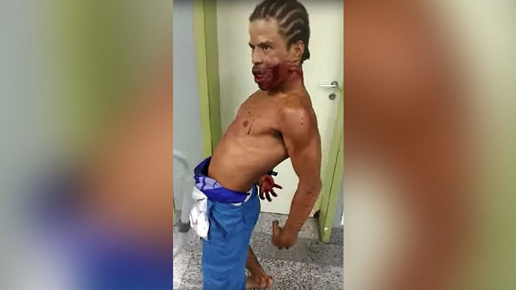 ¿Posesión en el hospital? Un hombre con un disparo en la cara aterroriza Brasil (FUERTES IMÁGENES)