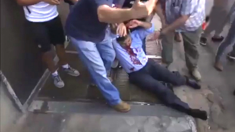 Video: Disparan en la cara a un diputado paraguayo durante manifestaciones en Asunción