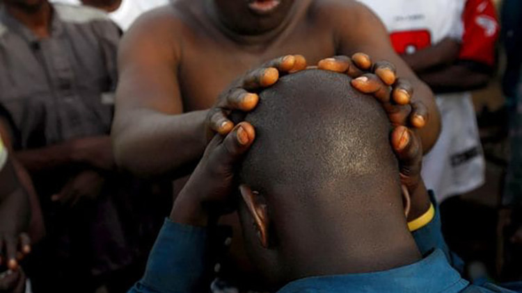 "Tienen oro en la cabeza": en este país africano ser calvo es muy peligroso