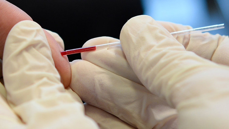 Científicos crean un anticuerpo que combate el 99 % de las cepas del VIH