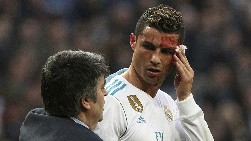 МЕМЕS: Cristiano Ronaldo se mira en un teléfono un corte en el rostro y la Red le ataca sin piedad