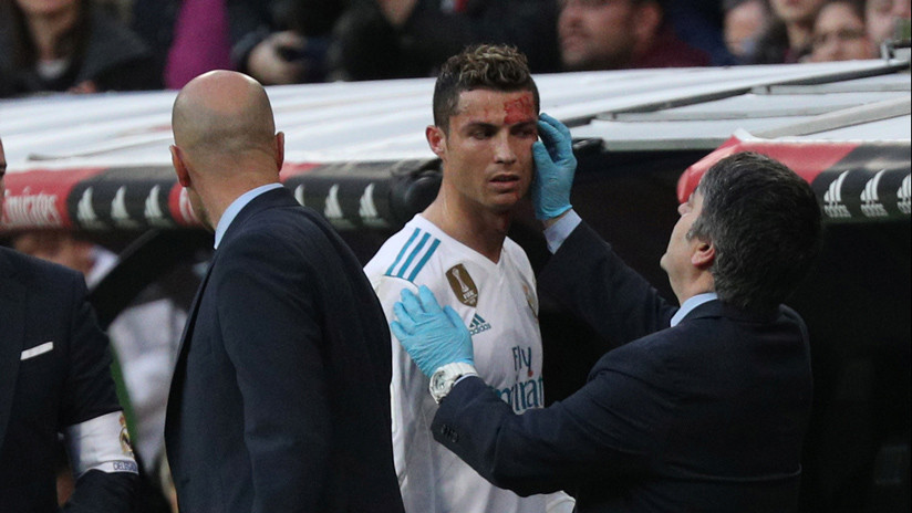 FOTO: Así le quedó la cara a Ronaldo tras el golpe que recibió en el último encuentro
