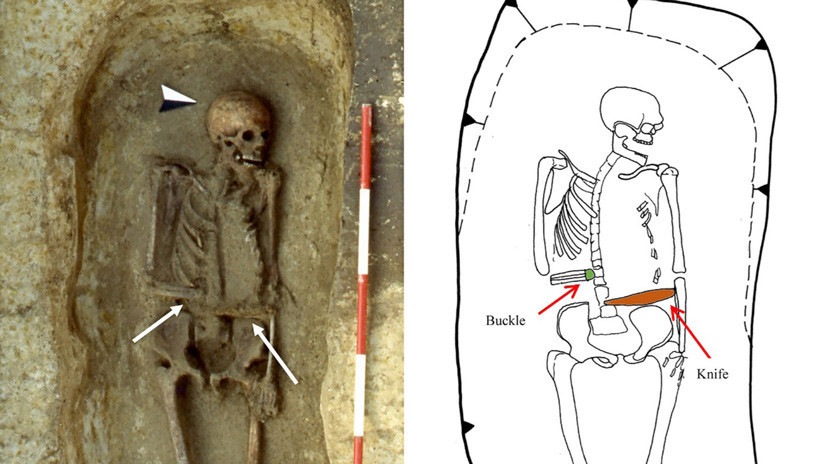 Sorpresa para antropólogos: Hallan en Italia un 'cíborg' medieval con un cuchillo en vez de mano