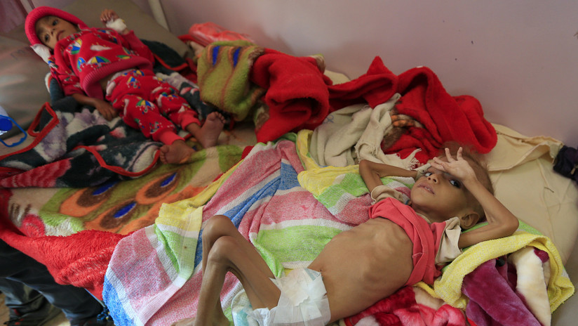 ONU: Más de la mitad de la población de Yemen está al borde de la inanición