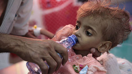 La "peor hambruna en 100 años" amenaza la vida de hasta 13 millones de personas en un solo país
