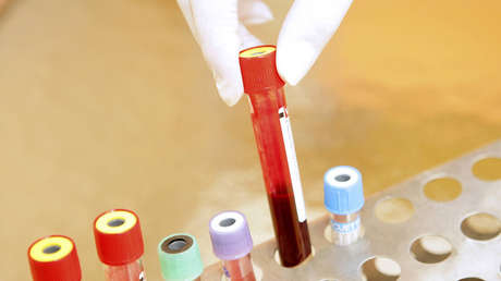Eliminan la presencia del virus del VIH en cinco pacientes mediante trasplantes de células madre