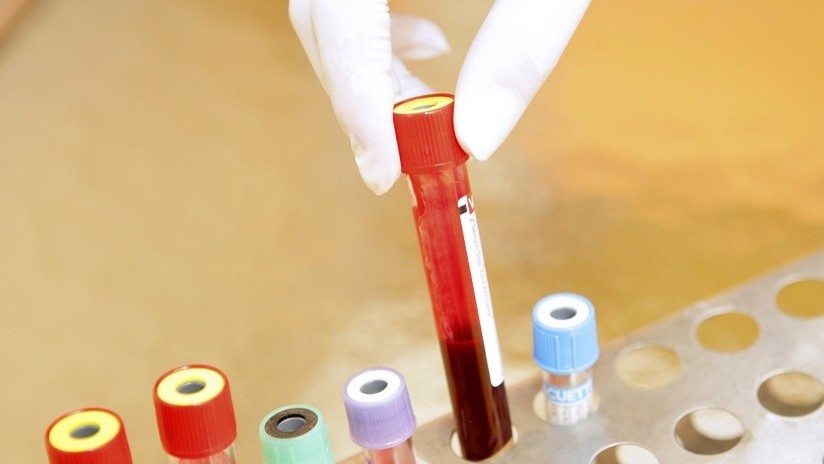 ¿Será el VIH pronto derrotado?: Descubren un modo para eliminar las células infectadas