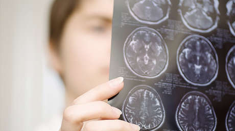 "Como si hicieran la ola": Descubren una forma extraña y nunca vista de conexión entre neuronas