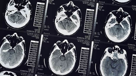 Demuestran que el cerebro humano produce nuevas neuronas hasta casi los 90 años