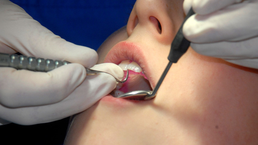 Un mujer muere desangrada luego de que dentista le extrajera diez dientes