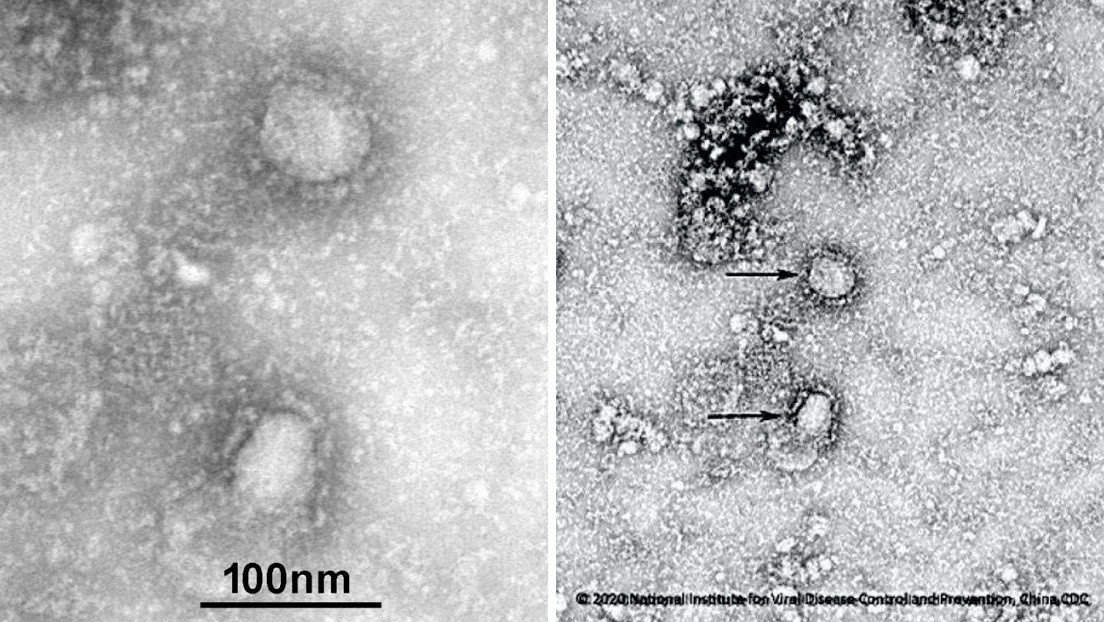 FOTO: Publican las primeras imágenes del mortal coronavirus originado en China