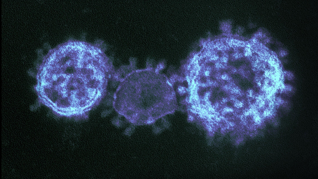 VIDEO: Australia cultiva una versión del coronavirus para acelerar el desarrollo de un remedio