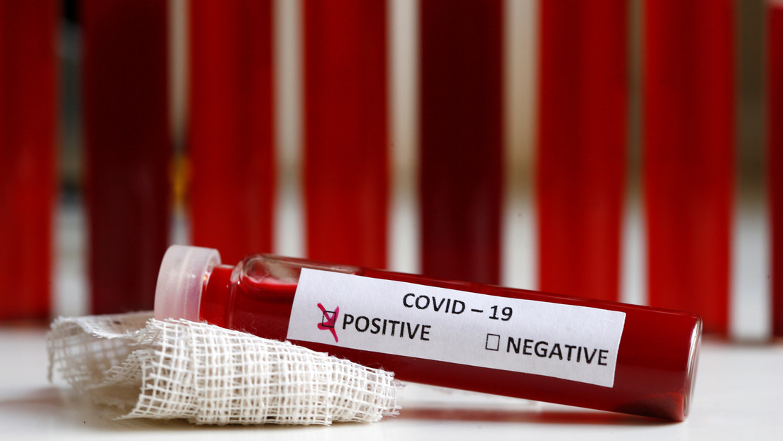 Revelan peligrosas confusiones en el diagnóstico del covid-19