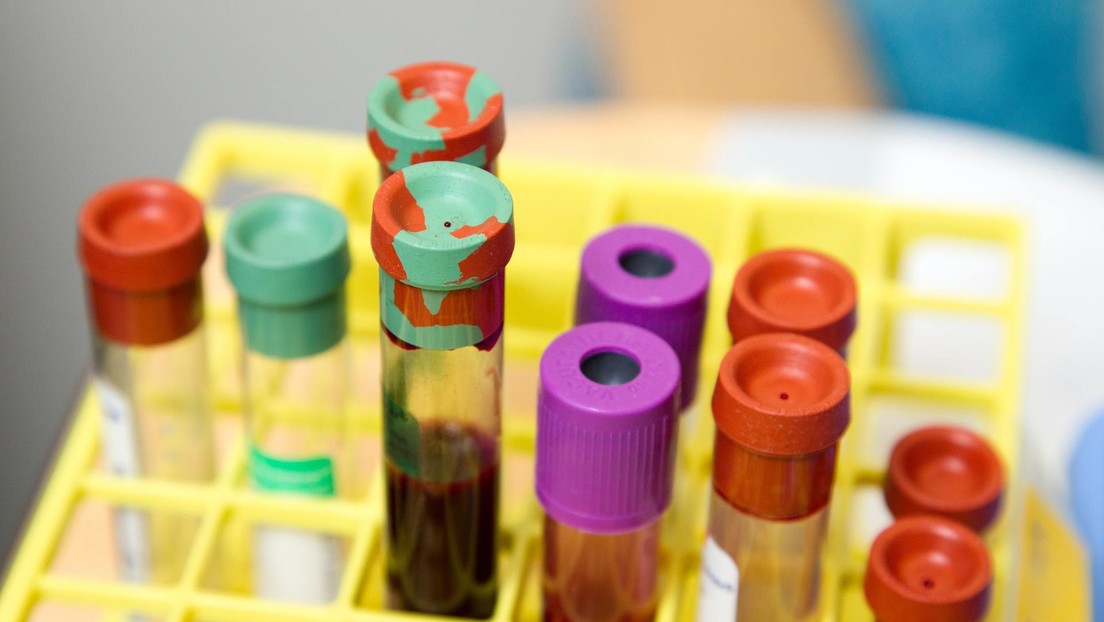 Científicos rusos planean registrar varias vacunas contra el covid-19 en agosto y septiembre