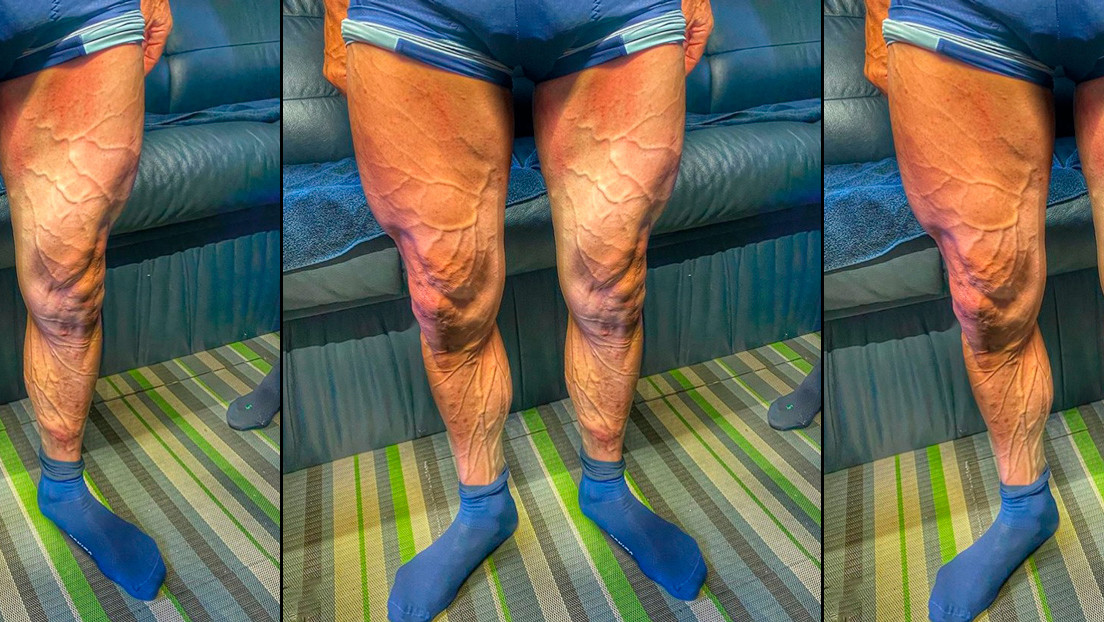 FOTO: Un ciclista muestra sus piernas con las venas 'a punto de estallar' durante la Vuelta a España
