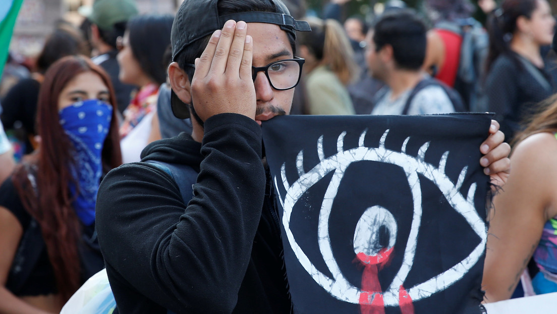 "He llorado, pero sigo de pie": Estudiante chileno comparte emotivo mensaje a un año de perder la vista por disparos de carabineros