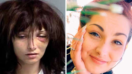 La impactante transformación de una joven adicta a la heroína tras años sin probar drogas