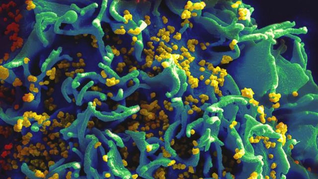 ¿Posible cura a la vista?: perfeccionan un método diseñado para "matar" las células infectadas por el VIH