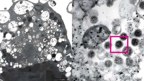Qué se sabe de la nueva versión de la variante ómicron, que se detectó en más de 40 países y podría ser 1,5 veces más infecciosa que su predecesora