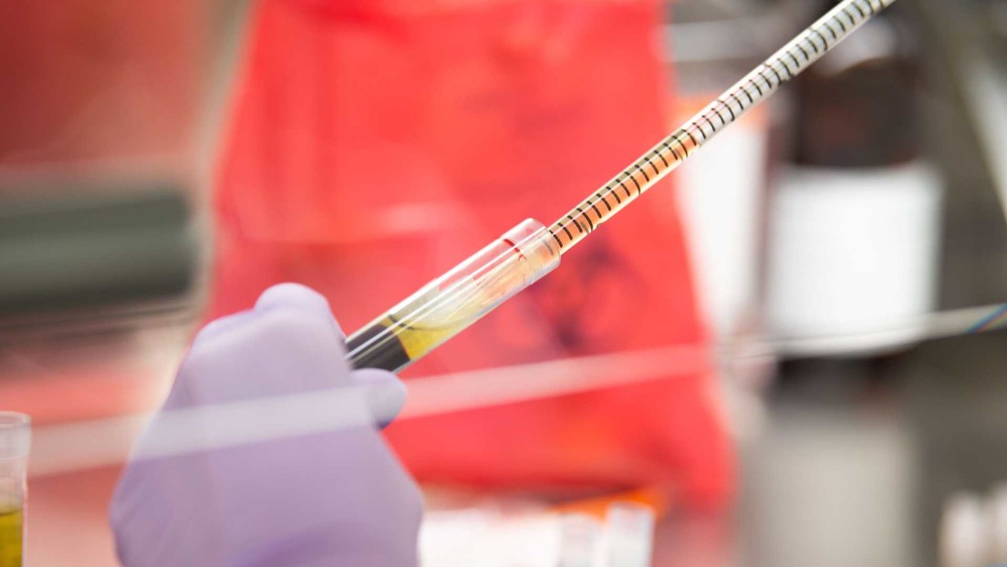 Un nuevo análisis de sangre detecta qué tan grave será la infección por covid-19