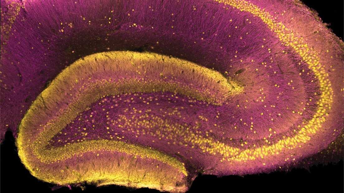 Identifican en qué región del cerebro se puede originar la esquizofrenia