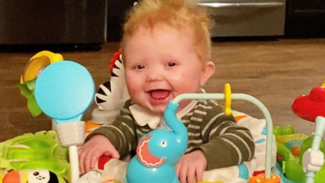 Un bebé de seis meses recibe el primer trasplante combinado de corazón y timo del mundo