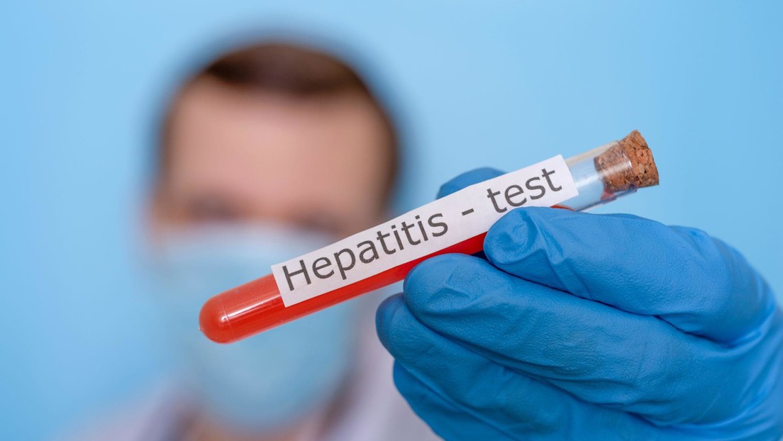 La OMS advierte de la detección de 650 casos potenciales de hepatitis infantil de origen desconocido en el mundo