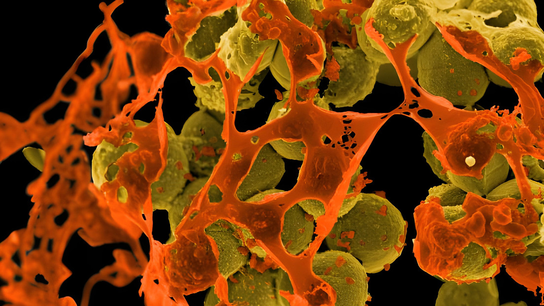 Las infecciones  y muertes por superbacterias resistentes a los antibióticos aumentaron durante la pandemia en EE.UU.