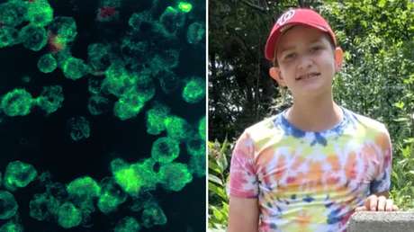 Un niño de 13 años se infecta con una ameba 'comecerebros' en una playa y lucha por su vida