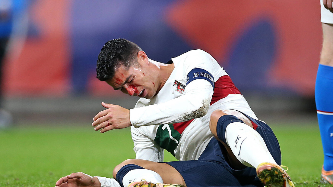 Ronaldo termina ensangrentado tras sufrir un duro golpe en la nariz durante un partido (VIDEO)