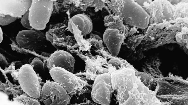 Una misma bacteria originó las pandemias de peste más devastadoras de la historia