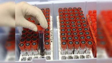 Hay suficiente sangre para los heridos en los hospitales de Moscú