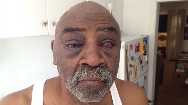Fotos: Un anciano sordo, golpeado por policías en EE.UU. por no oír sus órdenes
