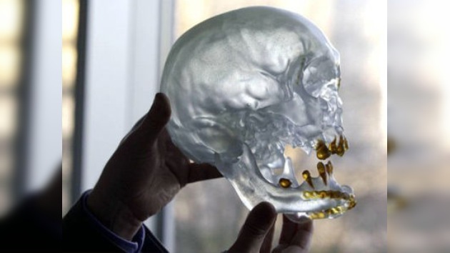 Se realiza el primer trasplante de cara en Bélgica