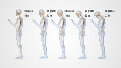 ¿Qué daño hace a las cervicales mirar constantemente el móvil?