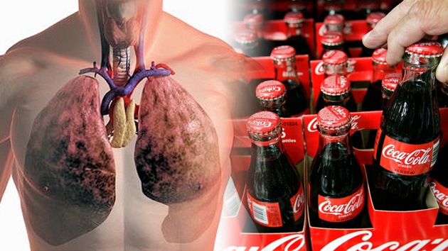 Adicto a Coca-Cola fallece con los pulmones hinchados cuatro veces más de lo normal