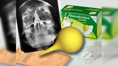 Flatulencia incontrolable y consumía cocaína: nuevos datos del cuadro clínico de Hitler