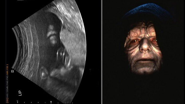 El emperador de Star Wars aparece en la ecografía de un bebé