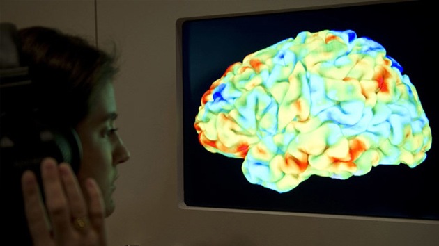 DARPA desarrolla un dispositivo capaz de 'leer' el cerebro en tiempo real
