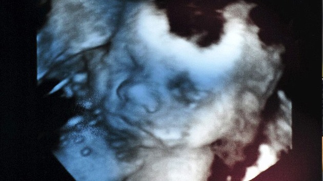 Estrella antes de nacer: una empresa de TV contrata a un feto, atraída por una ecografía